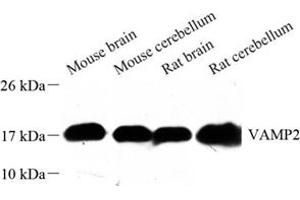 Western blot analysis of VAMP2 (ABIN7076197) at dilution of 1: 500