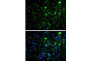 Immunofluorescence analysis of A-549 cells using SMYD4 antibody (ABIN6133038, ABIN6148171, ABIN6148172 and ABIN6223147). (SMYD4 antibody  (AA 1-260))