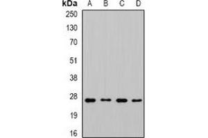 Western blot analysis of CHMP1B expression in MCF7 (A), SKOV3 (B), mouse liver (C), mouse brain (D) whole cell lysates. (CHMP1B antibody)