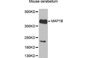 Western Blotting (WB) image for anti-Microtubule-Associated Protein 1B (MAP1B) (AA 1820-2100) antibody (ABIN6220205) (MAP1B antibody  (AA 1820-2100))