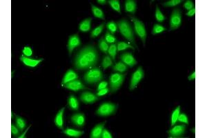 Immunofluorescence analysis of MCF7 cells using SPDEF antibody (ABIN6132572, ABIN6148332, ABIN6148334 and ABIN6218364). (SPDEF/PSE antibody  (AA 1-335))