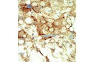 Image no. 2 for anti-Ret Proto-Oncogene (RET) (C-Term) antibody (ABIN359927)