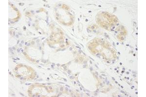 Immunohistochemistry (IHC) image for anti-Eukaryotic Translation Initiation Factor 2A, 65kDa (EIF2A) (AA 525-575) antibody (ABIN7448543) (EIF2A antibody  (AA 525-575))