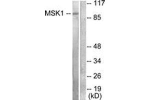 Western blot analysis of extracts from 293 cells, treated with UV 15', using MSK1 (Ab-581) Antibody. (MSK1 antibody  (AA 551-600))