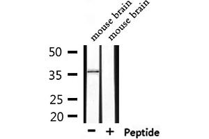 Western blot analysis of extracts from mouse brain, using ERCC1 Antibody. (ERCC1 antibody  (Internal Region))