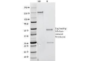 SDS-PAGE Analysis Purified IFNG Mouse Monoclonal Antibody (G-23). (Interferon gamma antibody)