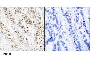 Image no. 1 for anti-Breast Cancer 1 (BRCA1) (pSer1524) antibody (ABIN196816) (BRCA1 antibody  (pSer1524))