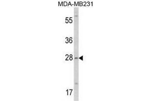 Image no. 1 for anti-Collectin Sub-Family Member 11 (COLEC11) (N-Term) antibody (ABIN452858)