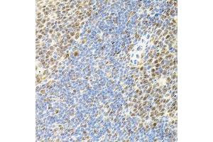 Immunohistochemistry of paraffin-embedded mouse spleen using EIF4G2 antibody. (EIF4G2 antibody  (AA 750-850))
