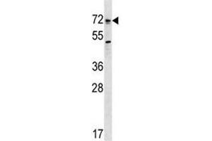 Western Blotting (WB) image for anti-Bone Morphogenetic Protein Receptor 1A (BMPR1A) (AA 170-197) antibody (ABIN3028516)
