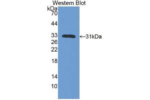 Western blot analysis of the recombinant protein. (IL7R antibody  (AA 1-239))