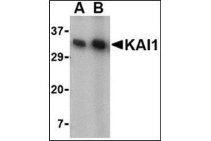 Western blot analysis of KAI1 in A549 cell lysate with this product at (A) 0. (CD82 antibody  (C-Term))