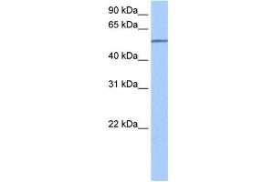 SEMA6D antibody used at 0. (SEMA6D antibody  (N-Term))
