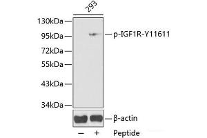 Western blot analysis of extracts from 293 cells using Phospho-IGF1R(Y1161) Polyclonal Antibody. (IGF1R antibody  (pTyr1161))