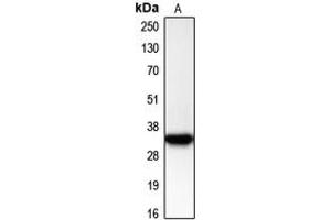 Western blot analysis of CDK2 expression in Jurkat (A) whole cell lysates.
