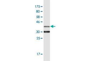 Western Blot detection against Immunogen (36. (SERPINB10 antibody  (AA 46-145))