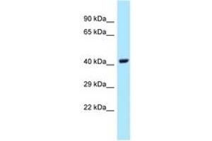 Image no. 1 for anti-Ubiquitin-Conjugating Enzyme E2Q Family Member 1 (UBE2Q1) (AA 174-223) antibody (ABIN6747967) (UBE2Q1 antibody  (AA 174-223))