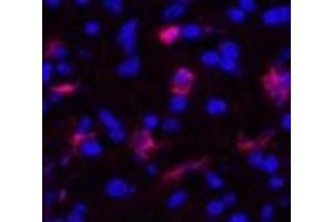 Immunofluorescence analysis of Human appendix tissue using FN1 Monoclonal Antibody at dilution of 1:200. (Fibronectin 1 antibody)