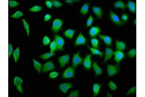 Immunofluorescence staining of A549 cells with ABIN7152106 at 1:100, counter-stained with DAPI. (EIF4A2 antibody  (AA 1-407))