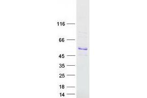 Validation with Western Blot (AGXT2 Protein (Myc-DYKDDDDK Tag))