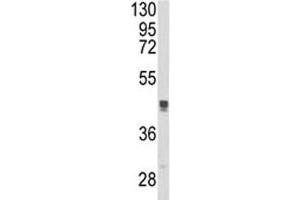 Western blot analysis of TGN46 antibody and MCF-7 lysate. (TGOLN2 antibody  (AA 399-427))