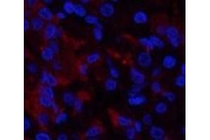 Immunofluorescence analysis of Human stomach tissue using RUNX2 Polyclonal Antibody at dilution of 1:200. (RUNX2 antibody)