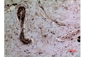 Immunohistochemistry (IHC) image for anti-X-Ray Repair Complementing Defective Repair in Chinese Hamster Cells 6 (XRCC6) (acLys542) antibody (ABIN3181890)