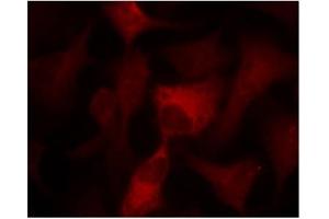 Image no. 3 for anti-Protein Kinase, AMP-Activated, alpha 1 Catalytic Subunit (PRKAA1) (Thr174) antibody (ABIN197410) (PRKAA1 antibody  (Thr174))