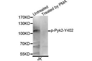 Western blot analysis of extracts of Jurkat cell line, using Phospho-Pyk2-Y402 antibody. (PTK2B antibody  (pTyr402))