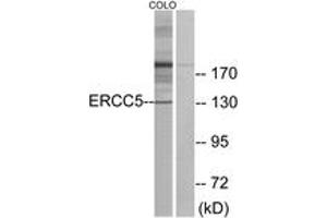 Western blot analysis of extracts from COLO cells, using ERCC5 Antibody. (ERCC5 antibody  (AA 131-180))