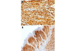 Immunohistochemical staining (Formalin-fixed paraffin-embedded sections) of human uterus (A) and rat uterus (B) with CNN1 recombinant monoclonal antibody, clone CNN1/1408R . (Recombinant CNN1 antibody)