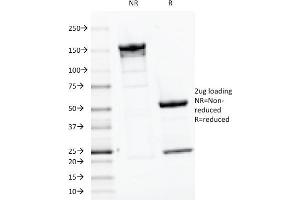 SDS-PAGE Analysis Purified PTH Mouse Monoclonal Antibody (PTH/1175). (PTH antibody  (AA 32-115))