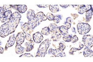 Detection of CHEM in Human Placenta Tissue using Monoclonal Antibody to Chemerin (CHEM) (CHEM (AA 33-158) antibody)