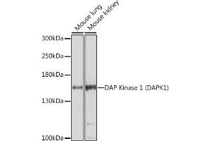 Western blot analysis of extracts of various cell lines, using DAP Kinase 1 (DAP Kinase 1 (D)) Antibody (ABIN6130240, ABIN6139401, ABIN6139402 and ABIN6221411) at 1:1000 dilution.