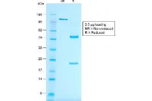 SDS-PAGE Analysis of Purified MART-1 Mouse Recombinant Monoclonal Antibody (rMLANA/788). (Recombinant MLANA antibody)