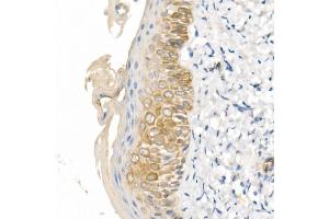 Immunohistochemistry of paraffin-embedded human skin using Cytokeratin 16 (KRT16) Rabbit pAb (ABIN6129541, ABIN6143021, ABIN6143022 and ABIN6223391) at dilution of 1:100 (40x lens). (KRT16 antibody  (AA 190-430))