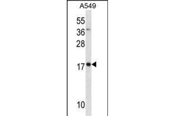 MYL4 antibody  (N-Term)