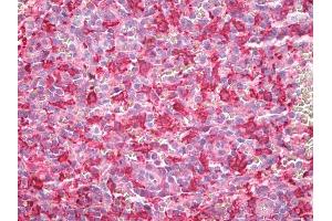 Anti-HMOX1 / HO-1 antibody IHC staining of human spleen, macrophages. (HMOX1 antibody  (AA 1-30))