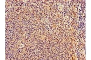 Immunohistochemistry of paraffin-embedded human lymph node tissue using ABIN7173031 at dilution of 1:100 (TMEM11 antibody  (AA 1-83))