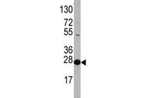 Western Blotting (WB) image for anti-Eukaryotic Translation Initiation Factor 4E (EIF4E) (AA 32-61) antibody (ABIN3030893)