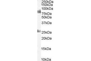 Western Blotting (WB) image for Chromodomain Protein, Y-Like (CDYL) peptide (ABIN369898)