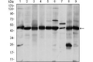 Western Blotting (WB) image for anti-Argininosuccinate Synthase 1 (ASS1) antibody (ABIN1845465)