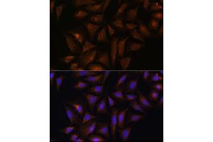 Immunofluorescence analysis of U-2 OS cells using CRYZ Rabbit pAb  at dilution of 1:100 (40x lens). (CRYZ antibody  (AA 1-329))