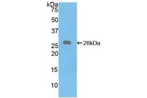 Detection of Recombinant PKD2, Human using Polyclonal Antibody to Protein Kinase D2 (PKD2) (PKD2 antibody  (AA 621-832))