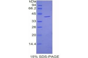 SDS-PAGE analysis of Mouse Cholecystokinin Protein.