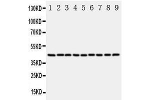 Western Blotting (WB) image for anti-Actin, beta (ACTB) (AA 2-19), (N-Term) antibody (ABIN3044573) (beta Actin antibody  (N-Term))