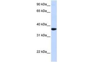 Image no. 1 for anti-Secretagogin, EF-Hand Calcium Binding Protein (SCGN) (AA 180-229) antibody (ABIN6743096)