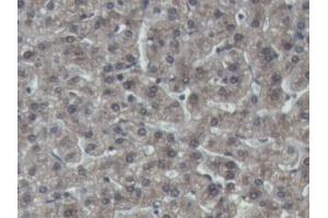 IHC-P analysis of Pig Liver Tissue, with DAB staining. (IGFBP4 antibody  (AA 23-259))