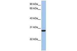 VDAC3 antibody used at 1 ug/ml to detect target protein. (VDAC3 antibody  (N-Term))