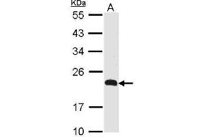 WB Image Sample (30 ug of whole cell lysate) A: Raji 12% SDS PAGE CKLFSF5 antibody antibody diluted at 1:500 (CMTM5 antibody  (N-Term))